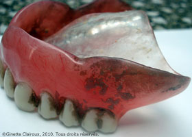 Dentier de ma mère